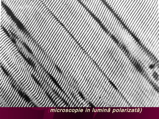 (microscopie in lumin ă polarizată)

 