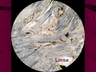 Limba

 