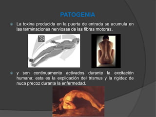 PATOGENIA
 La toxina producida en la puerta de entrada se acumula en
las terminaciones nerviosas de las fibras motoras.
 y son continuamente activados durante la excitación
humana; esta es la explicación del trismus y la rigidez de
nuca precoz durante la enfermedad.
 