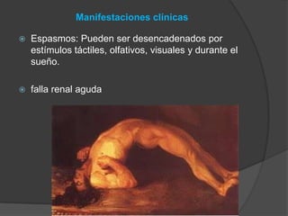 Manifestaciones clínicas
 Espasmos: Pueden ser desencadenados por
estímulos táctiles, olfativos, visuales y durante el
sueño.
 falla renal aguda
 
