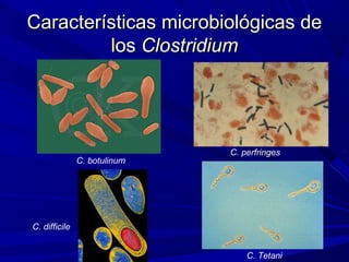 Características microbiológicas deCaracterísticas microbiológicas de
loslos ClostridiumClostridium
C. Tetani
C. botulinum
C. perfringes
C. difficile
 