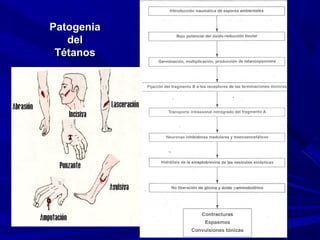 PatogeniaPatogenia
deldel
TétanosTétanos
 