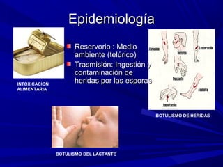 EpidemiologíaEpidemiología
Reservorio : MedioReservorio : Medio
ambiente (telúrico)ambiente (telúrico)
Trasmisión: Ingestión yTrasmisión: Ingestión y
contaminación decontaminación de
heridas por las esporasheridas por las esporasINTOXICACION
ALIMENTARIA
BOTULISMO DE HERIDAS
BOTULISMO DEL LACTANTE
 