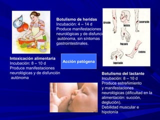 Acción patógena
Intoxicación alimentaria
Incubación: 8 – 10 d
Produce manifestaciones
neurológicas y de disfunción
autónoma
Botulismo de heridas
Incubación: 4 – 14 d
Produce manifestaciones
neurológicas y de disfunción
autónoma, sin síntomas
gastrointestinales.
Botulismo del lactante
Incubación: 8 – 10 d
Produce estreñimiento
y manifestaciones
neurológicas (dificultad en la
alimentación: succión,
deglución).
Debilidad muscular e
hipotonía
 