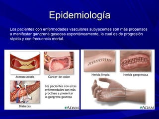 EpidemiologíaEpidemiología
Los pacientes con enfermedades vasculares subyacentes son más propensos
a manifestar gangrena gaseosa espontáneamente, la cual es de progresión
rápida y con frecuencia mortal.
 