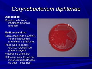 Corynebacterium diphteriaeCorynebacterium diphteriae
DiagnósticoDiagnóstico::
Muestra de la zonaMuestra de la zona
inflamada hisopo oinflamada hisopo o
raspadoraspado
Medios de cultivoMedios de cultivo
Suero coagulado (Loeffler),Suero coagulado (Loeffler),
colonias pequeñascolonias pequeñas
granulares y grisáceas.granulares y grisáceas.
Placa Gelosa sangre +Placa Gelosa sangre +
telurito, colonias sontelurito, colonias son
grises a negras.grises a negras.
Pruebas de virulenciaPruebas de virulencia
Detección de la toxina porDetección de la toxina por
inmunodifusión (Placasinmunodifusión (Placas
de agar – Test Elek)de agar – Test Elek)
 