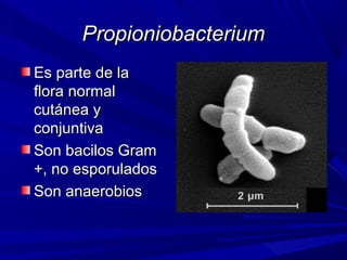 PropioniobacteriumPropioniobacterium
Es parte de laEs parte de la
flora normalflora normal
cutánea ycutánea y
conjuntivaconjuntiva
Son bacilos GramSon bacilos Gram
+, no esporulados+, no esporulados
Son anaerobiosSon anaerobios
 