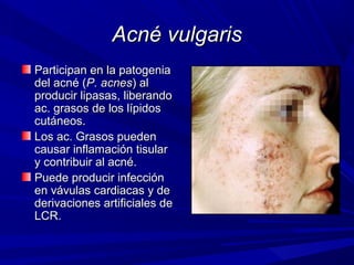 Acné vulgarisAcné vulgaris
Participan en la patogeniaParticipan en la patogenia
del acné (del acné (P. acnesP. acnes) al) al
producir lipasas, liberandoproducir lipasas, liberando
ac. grasos de los lípidosac. grasos de los lípidos
cutáneos.cutáneos.
Los ac. Grasos puedenLos ac. Grasos pueden
causar inflamación tisularcausar inflamación tisular
y contribuir al acné.y contribuir al acné.
Puede producir infecciónPuede producir infección
en vávulas cardiacas y deen vávulas cardiacas y de
derivaciones artificiales dederivaciones artificiales de
LCR.LCR.
 