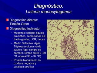 Diagnóstico:Diagnóstico:
Listeria monocytogenesListeria monocytogenes
Diagnóstico directo:Diagnóstico directo:
Tinción GramTinción Gram
Diagnóstico indirecto:Diagnóstico indirecto:
– Muestras: sangre, líquidoMuestras: sangre, líquido
amniótico, secreciones deamniótico, secreciones de
tracto genital, LCR, hecestracto genital, LCR, heces
– Medio Selectivo: AgarMedio Selectivo: Agar
Triptosa (colonia verdeTriptosa (colonia verde
azul) o Agar sangre deazul) o Agar sangre de
carnero. (crece entre 0 -50carnero. (crece entre 0 -50
°C, normal 30 – 37 °C)°C, normal 30 – 37 °C)
– Prueba bioquímica: esPrueba bioquímica: es
oxidasa negativa yoxidasa negativa y
catalasa positivacatalasa positiva
 