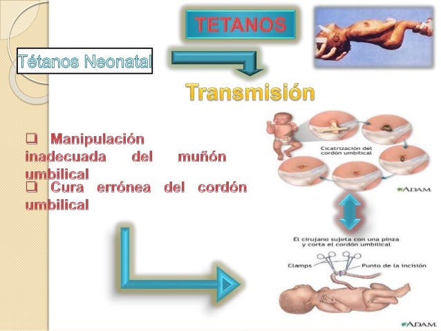 cadena epidemiologica tetanos tetano cadena epidemiologica tetanos tetano