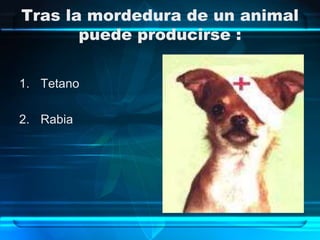 Tras la mordedura de un animal
puede producirse :
1. Tetano
2. Rabia
 