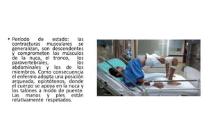 • Período de estado: las
contracturas musculares se
generalizan, son descendentes
y comprometen los músculos
de la nuca, el tronco, los
paravertebrales, los
abdominales y los de los
miembros. Como consecuencia
el enfermo adopta una posición
arqueada, opistótonos, donde
el cuerpo se apoya en la nuca y
los talones a modo de puente.
Las manos y pies están
relativamente respetados.
 