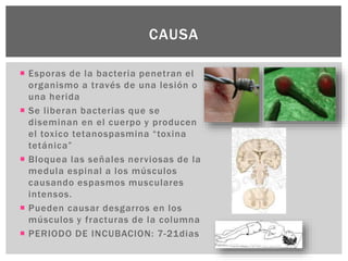  Esporas de la bacteria penetran el
organismo a través de una lesión o
una herida
 Se liberan bacterias que se
diseminan en el cuerpo y producen
el toxico tetanospasmina “toxina
tetánica”
 Bloquea las señales nerviosas de la
medula espinal a los músculos
causando espasmos musculares
intensos.
 Pueden causar desgarros en los
músculos y fracturas de la columna
 PERIODO DE INCUBACION: 7-21dias
CAUSA
 