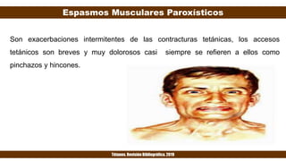 Espasmos Musculares Paroxísticos
Tétanos. Revisión Bibliográfica. 2019
Son exacerbaciones intermitentes de las contracturas tetánicas, los accesos
tetánicos son breves y muy dolorosos casi siempre se refieren a ellos como
pinchazos y hincones.
 