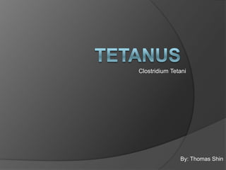 Clostridium Tetani




               By: Thomas Shin
 
