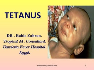 TETANUS DR . Rabie Zahran. Tropical M . Consultant. Damietta Fever Hospital. Egypt. [email_address] 