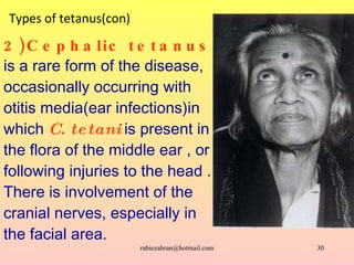 Types of tetanus(con) 2)Cephalic tetanus   is a rare form of the disease, occasionally occurring with otitis media(ear inf...