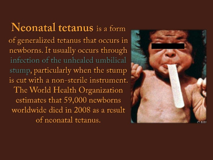 Tetanus