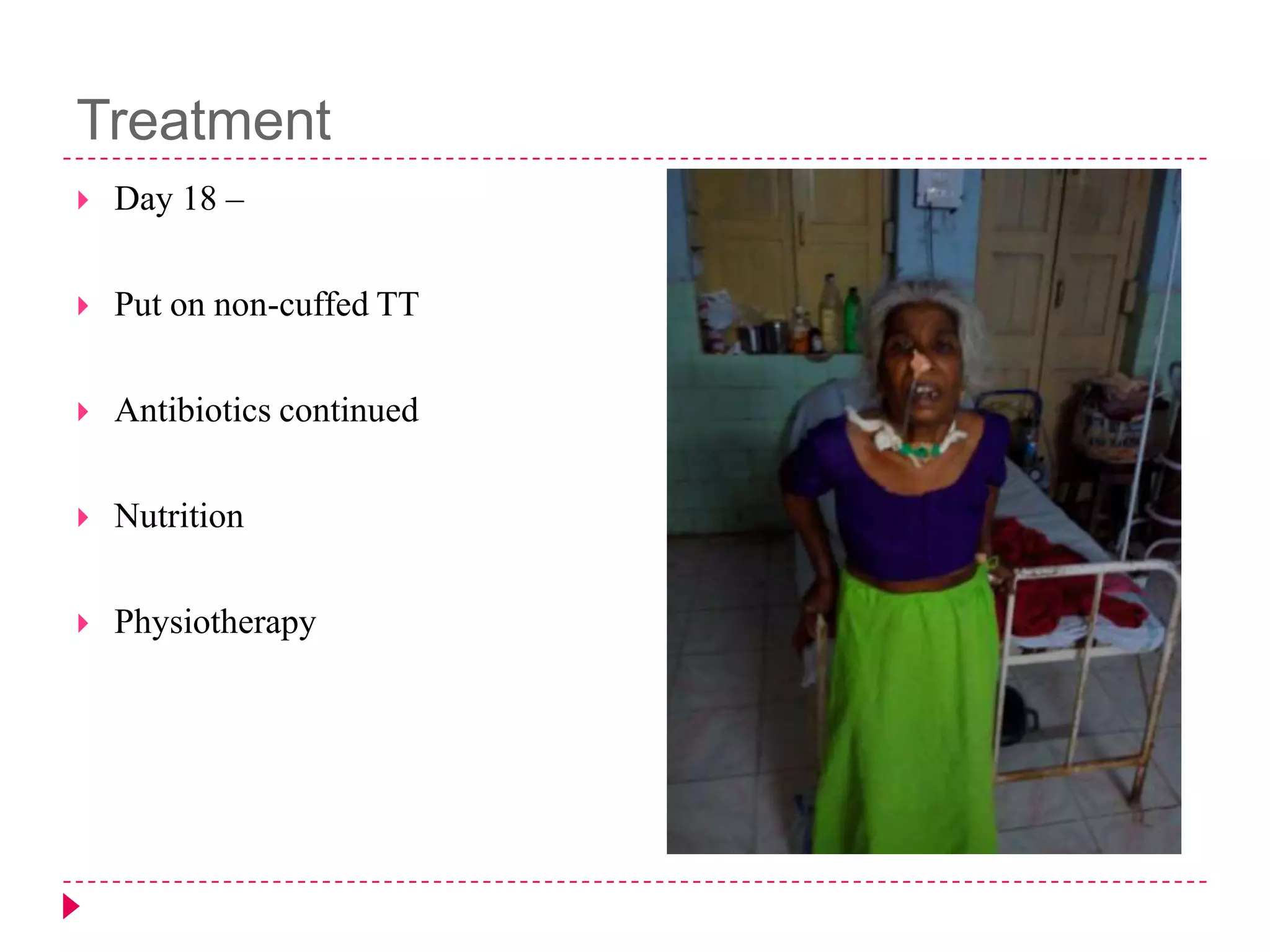 Treatment


Day 18 –



Put on non-cuffed TT



Antibiotics continued



Nutrition



Physiotherapy

 