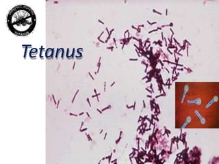 Tetanus
 