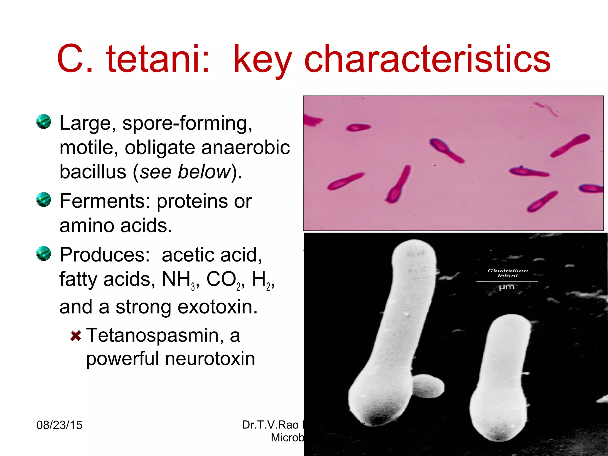 Tetanus Teaching basics | PPT