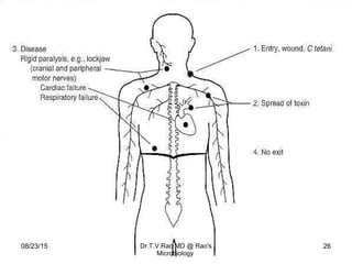 Tetanus Teaching basics | PPT