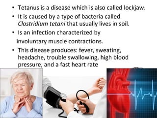 Tetanus | PPT