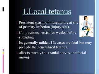 Tetanus Injuries Tetanus | PPTX