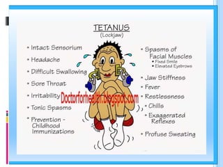 Tetanus | PPTX