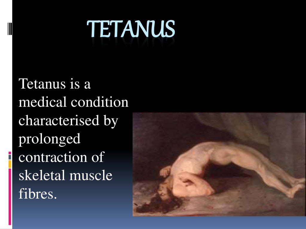 Tetanus