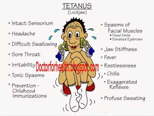 Tetanus tetanus