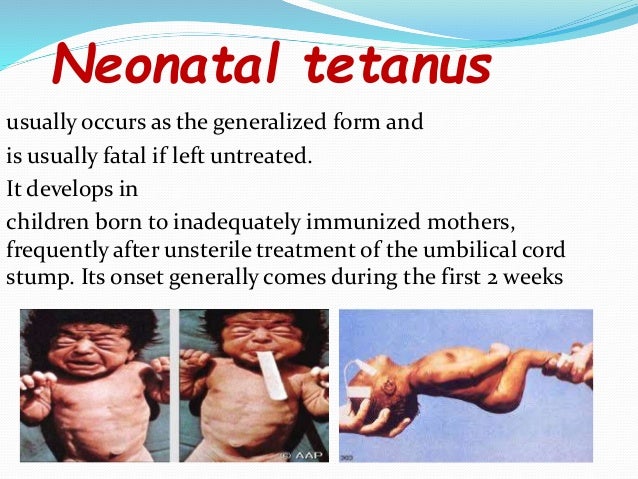 Dissertation tetanus