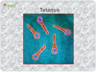 Tetanus | PPTX