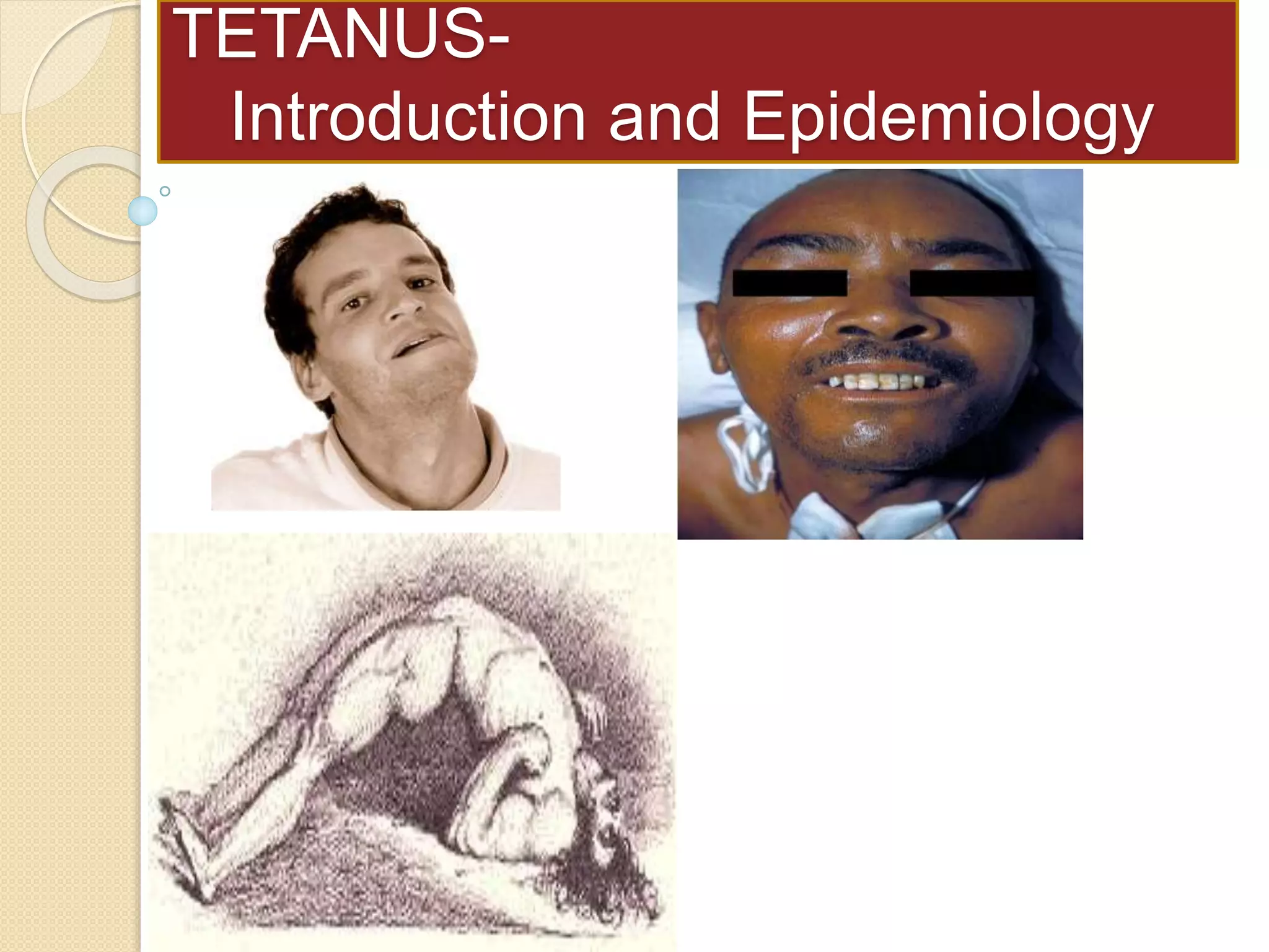 Tetanus- Introduction and Its epidemiology in Nepal | PPTX