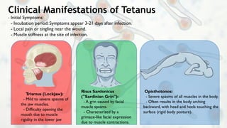 TETANUS Information From Definition To Treatment PPTX