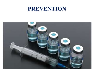 PREVENTION
 