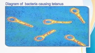 Tetanus | PPTX