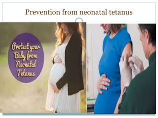 Prevention from neonatal tetanus
 