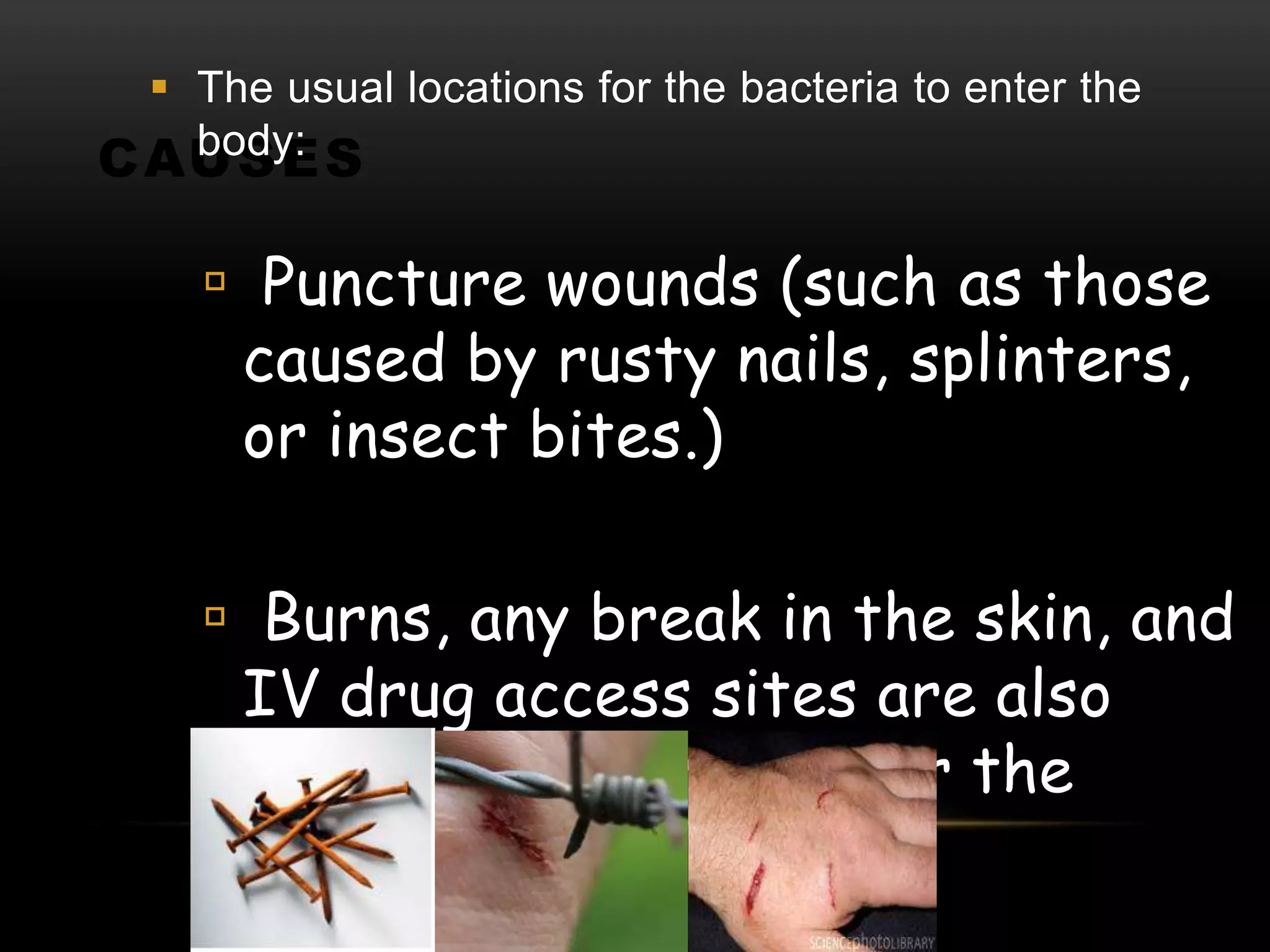 CAUSES
 The usual locations for the bacteria to enter the
body:
 Puncture wounds (such as those
caused by rusty nails, splinters,
or insect bites.)
 Burns, any break in the skin, and
IV drug access sites are also
potential entryways for the
bacteria.
 
