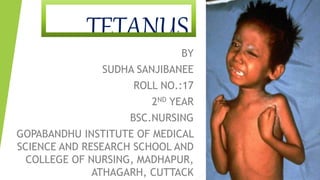 TETANUS
BY
SUDHA SANJIBANEE
ROLL NO.:17
2ND YEAR
BSC.NURSING
GOPABANDHU INSTITUTE OF MEDICAL
SCIENCE AND RESEARCH SCHOOL AND
COLLEGE OF NURSING, MADHAPUR,
ATHAGARH, CUTTACK
 
