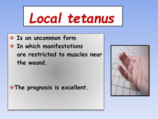 tetanus.pptx