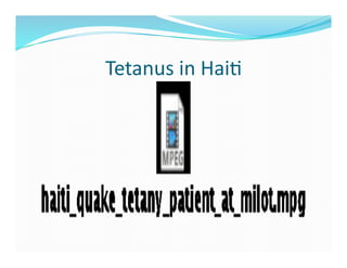 Tetanus	
  in	
  Hai>	
  
 