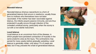 Tetanus Disease infectious diseases.pptx