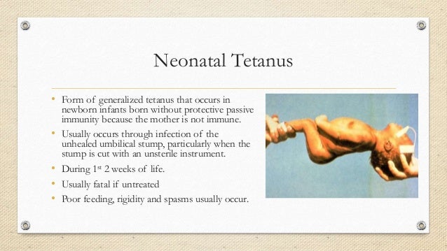 Tetanus