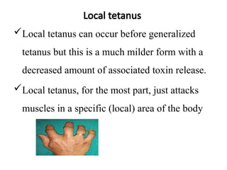 Tetanus medical surgical nursingppt.pptx