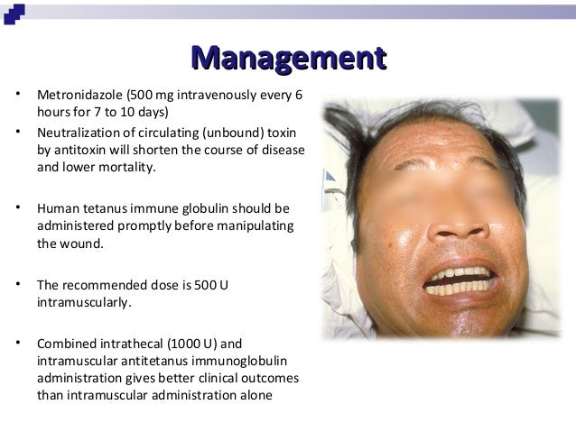 SEARCH AND BUY THIS PRODUCT Tetanus-strichnine toxicity & rabies