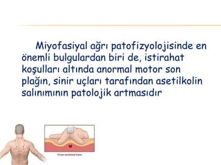 Miyofasiyal ağrı patofizyolojisinde en
önemli bulgulardan biri de, istirahat
koşulları altında anormal motor son
plağın, sinir uçları tarafından asetilkolin
salınımının patolojik artmasıdır
 