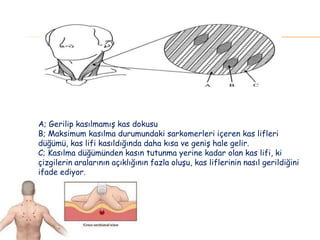 A; Gerilip kasılmamış kas dokusu
B; Maksimum kasılma durumundaki sarkomerleri içeren kas lifleri
düğümü, kas lifi kasıldığında daha kısa ve geniş hale gelir.
C; Kasılma düğümünden kasın tutunma yerine kadar olan kas lifi, ki
çizgilerin aralarının açıklığının fazla oluşu, kas liflerinin nasıl gerildiğini
ifade ediyor.
 