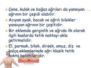  Çene, kulak ve boğaz ağrıları da yansıyan
ağrının bir çeşidi olabilir.
 Acıyan ayak, bacak ve ağrılı bilekler
yansıyan ağrının bir çeşitidir.
 Bir eklemde gerginlik ve ağrıda ilk olarak
ilgili kaslarda tetik noktayı akla
getirmelidir.
 El, parmak, bilek, dirsek, omuz, diz ve
kalça eklemlerinde ağrı klasik tetik
nokta belirtileridir.
 
