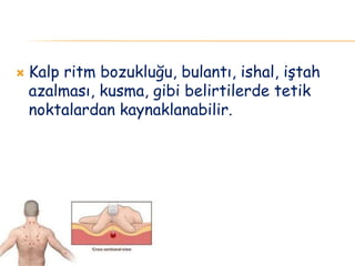  Kalp ritm bozukluğu, bulantı, ishal, iştah
azalması, kusma, gibi belirtilerde tetik
noktalardan kaynaklanabilir.
 